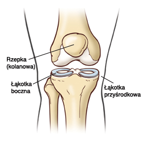 rzepka (kolanowa), łąkotka boczna, łąkotka przyśrodkowa