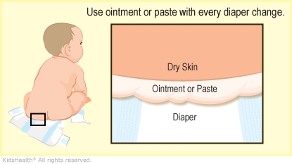 KidsHealth Image