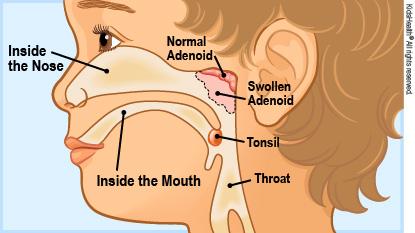 KidsHealth Image