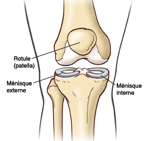 Rotule (patella), ménisque externe, ménisque interne