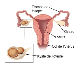 Trompe de Fallope, ovaire, utérus, col de l'utérus, kyste de l'ovaire